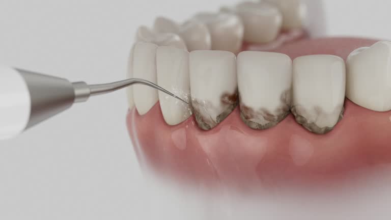 Trusted Invisalign Clear Aligners service in North Wildwood, NJ - Dentist Open Now